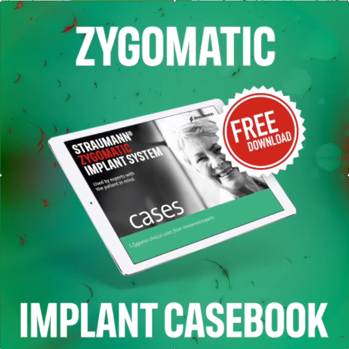 Zygomatic casebook