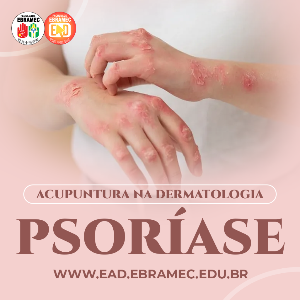 Psorise