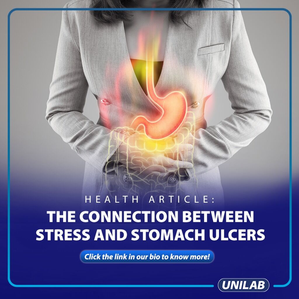 The Connection Between Stress and Stomach Ulcers