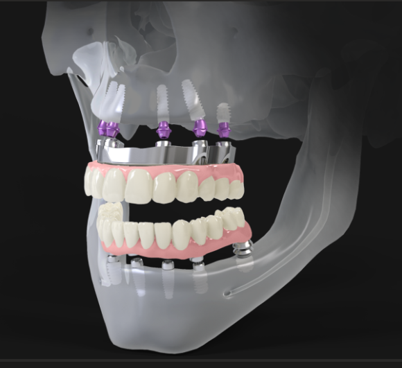 Webinar: Pro Arch Tissue level