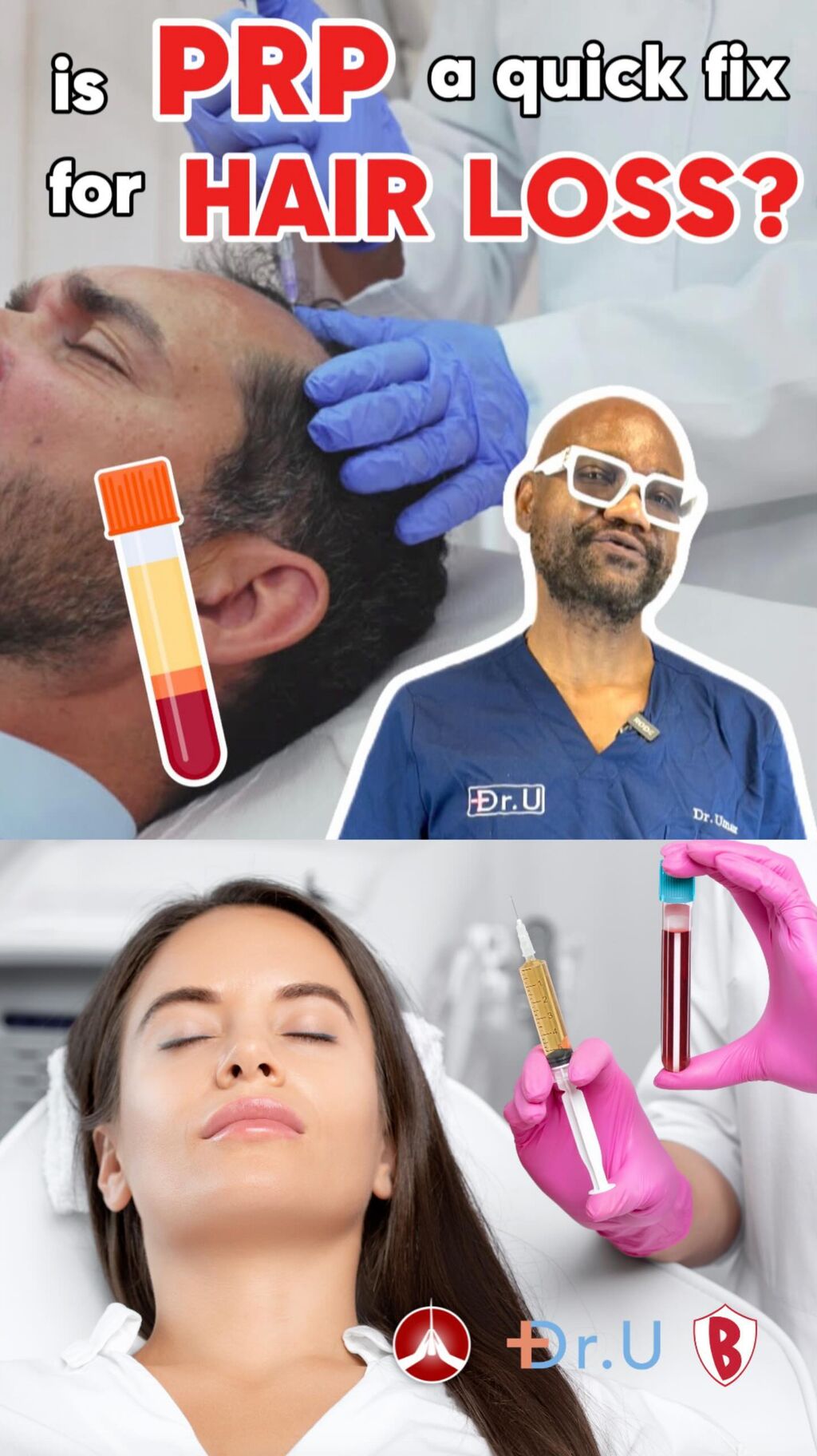 What Is PRP Plus: Is Platelet Rich Plasma for Hair Loss Beneficial?