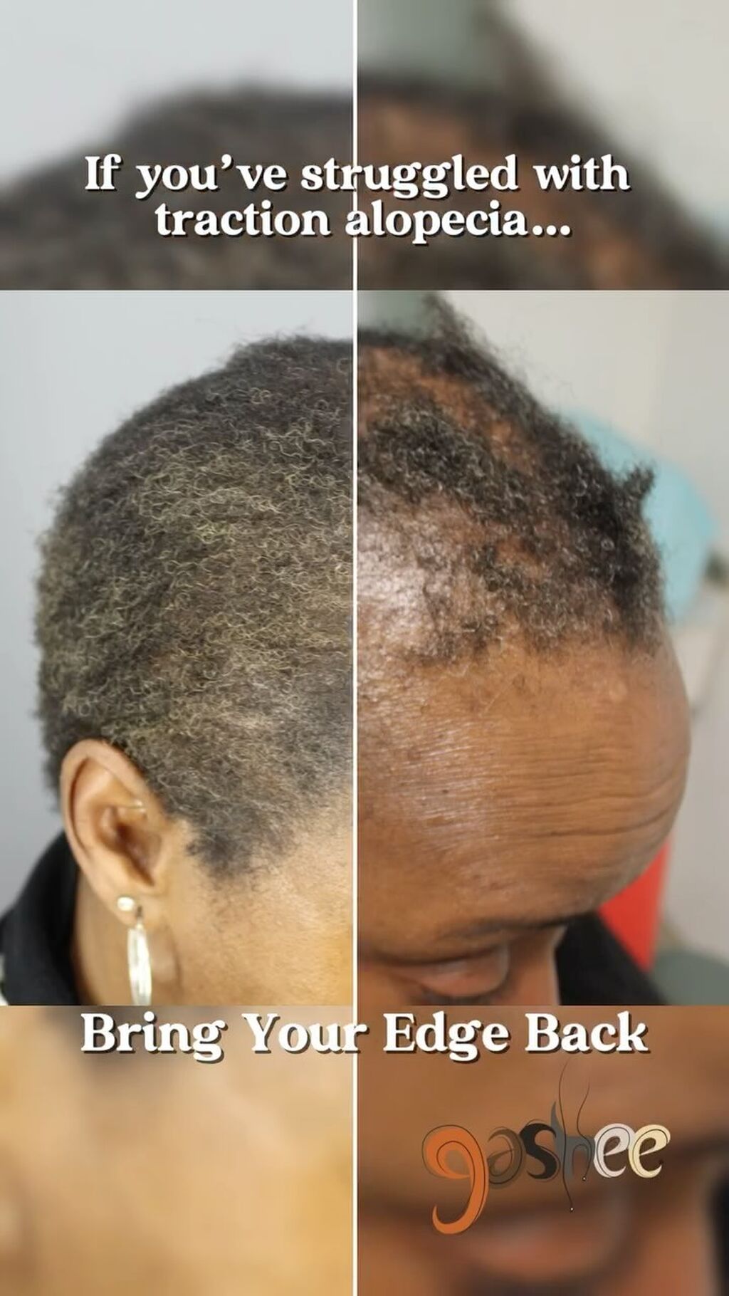 Gashee Hair Stories: Diane Llorens, Bring Your Edge Back