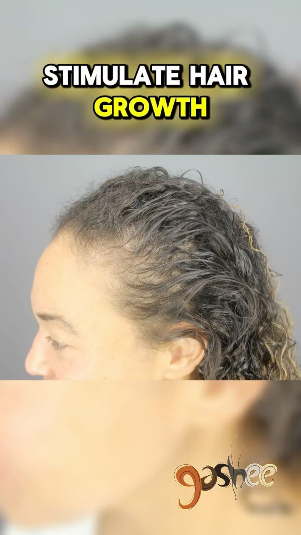 GASHEE Hair Stories: Natural Hair Growth Solution with Results