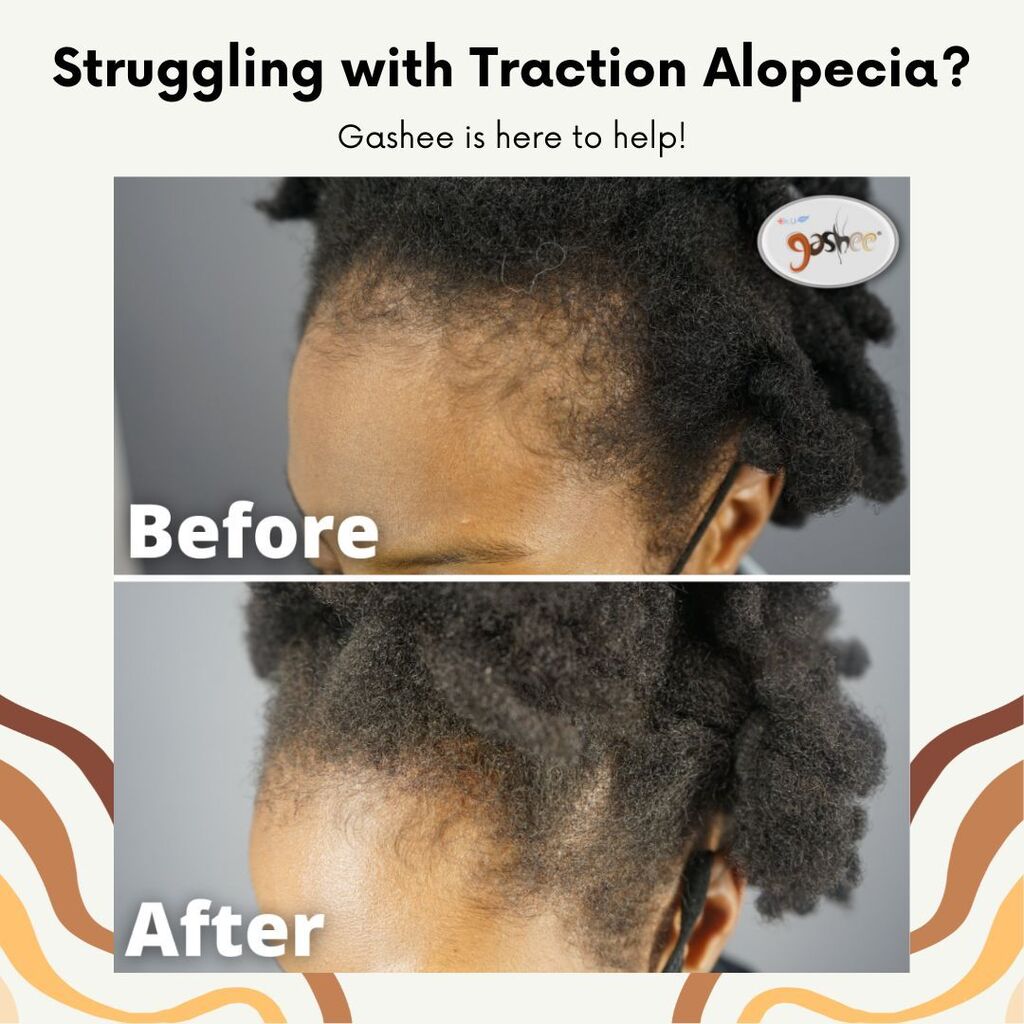 GASHEE Hair Stories: Improved Sheen, Shine & Texture