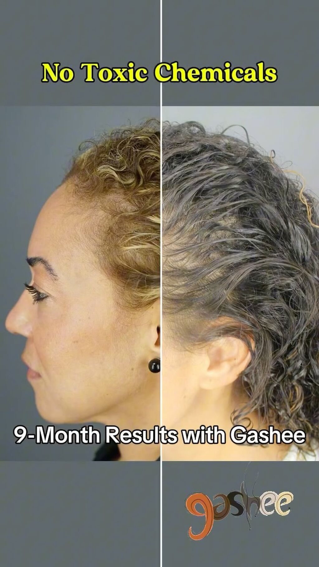 GASHEE Hair Stories: Natural Hair Growth Solution with Results