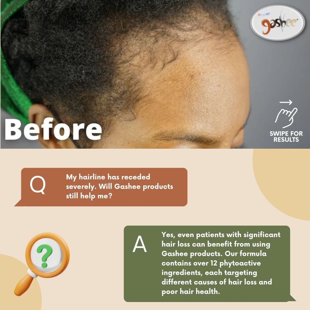GASHEE Hair Stories: Improved Sheen, Shine & Texture