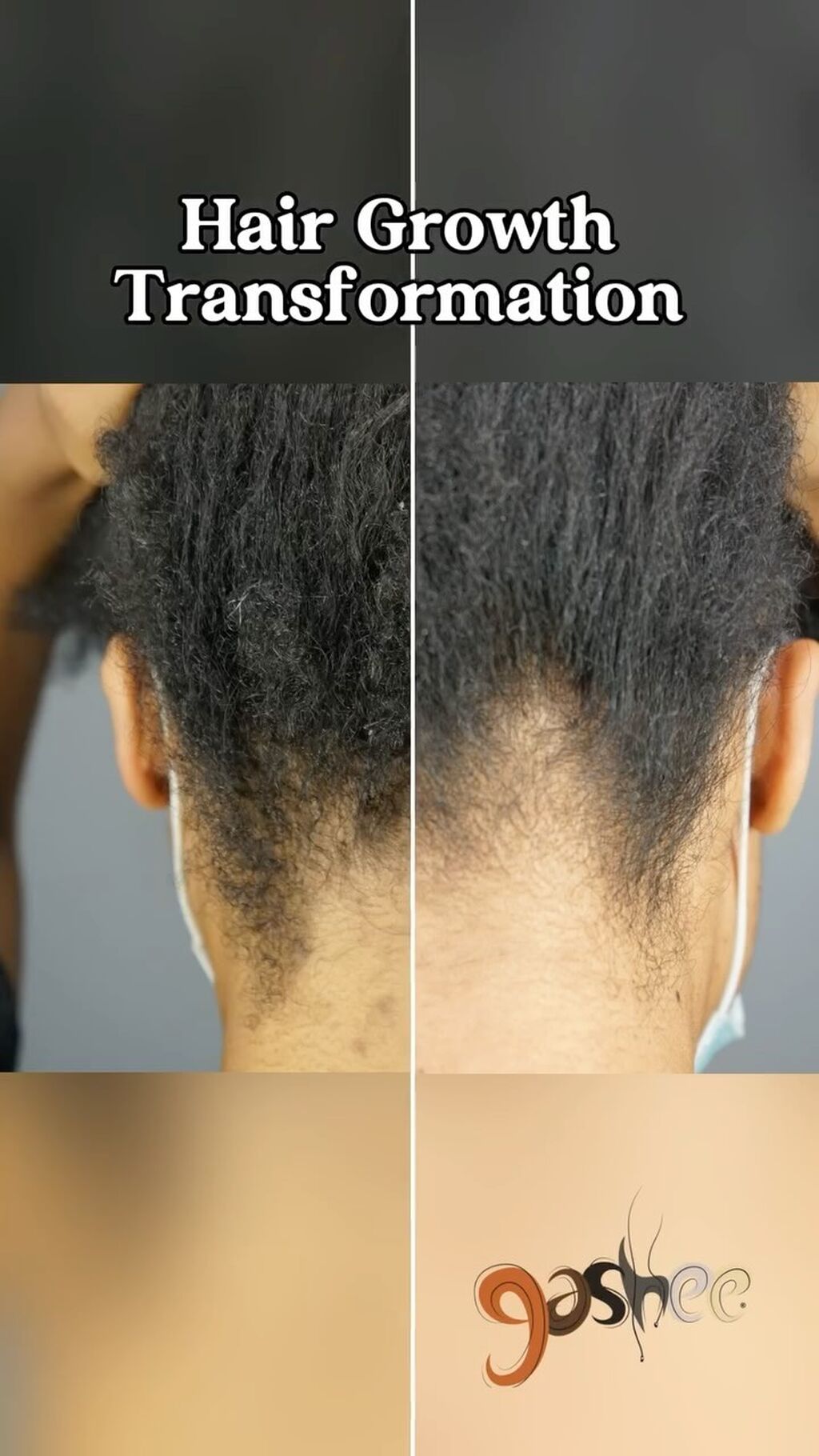 GASHEE Hair Stories: Improved Sheen, Shine & Texture