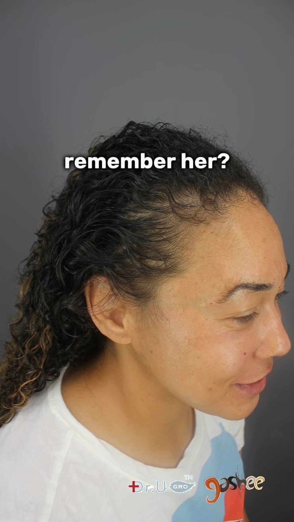 GASHEE Hair Stories: Natural Hair Growth Solution with Results