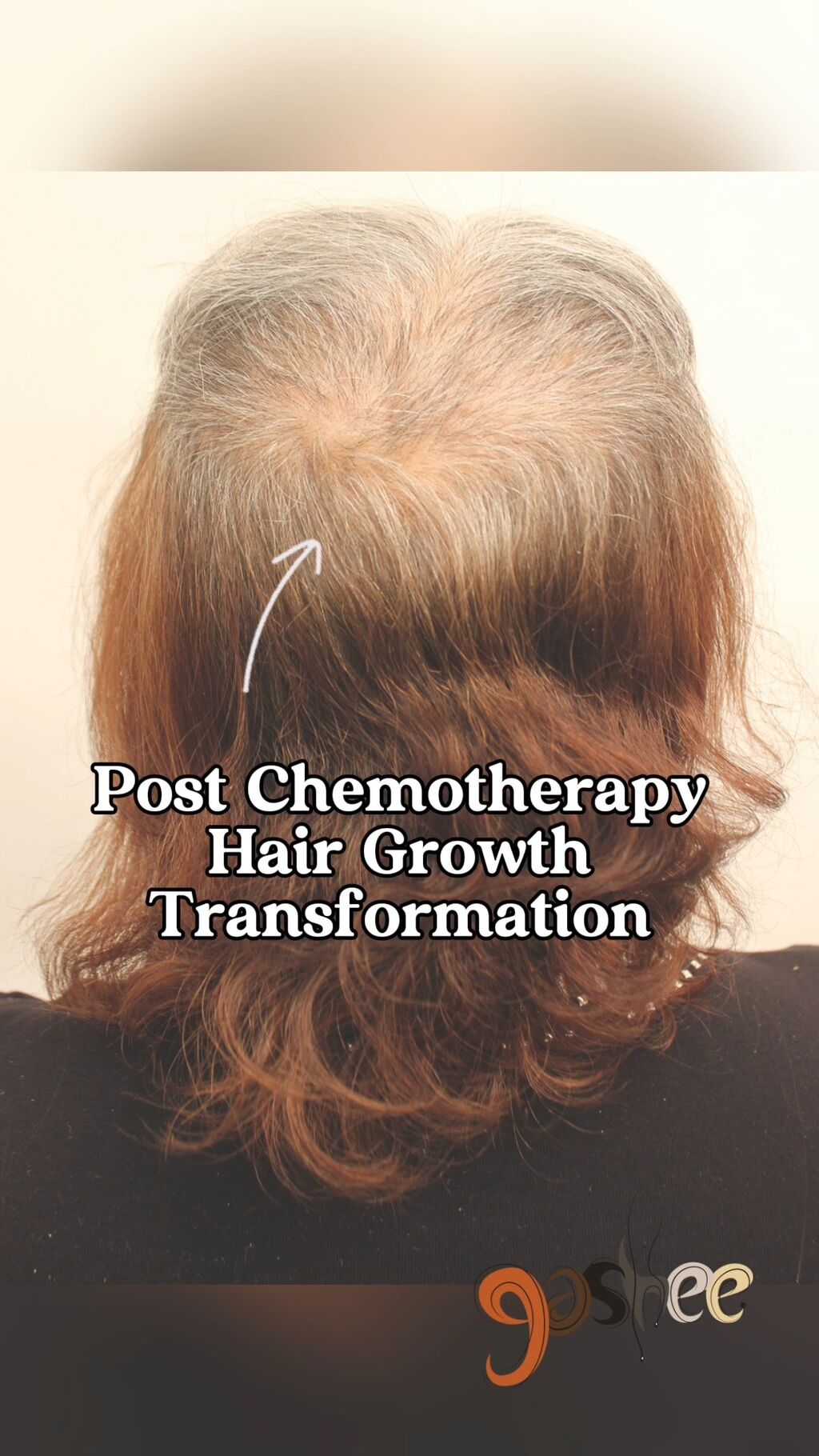 Fighting Hair Frustrations - Unearthing Natural Hair Care Solutions