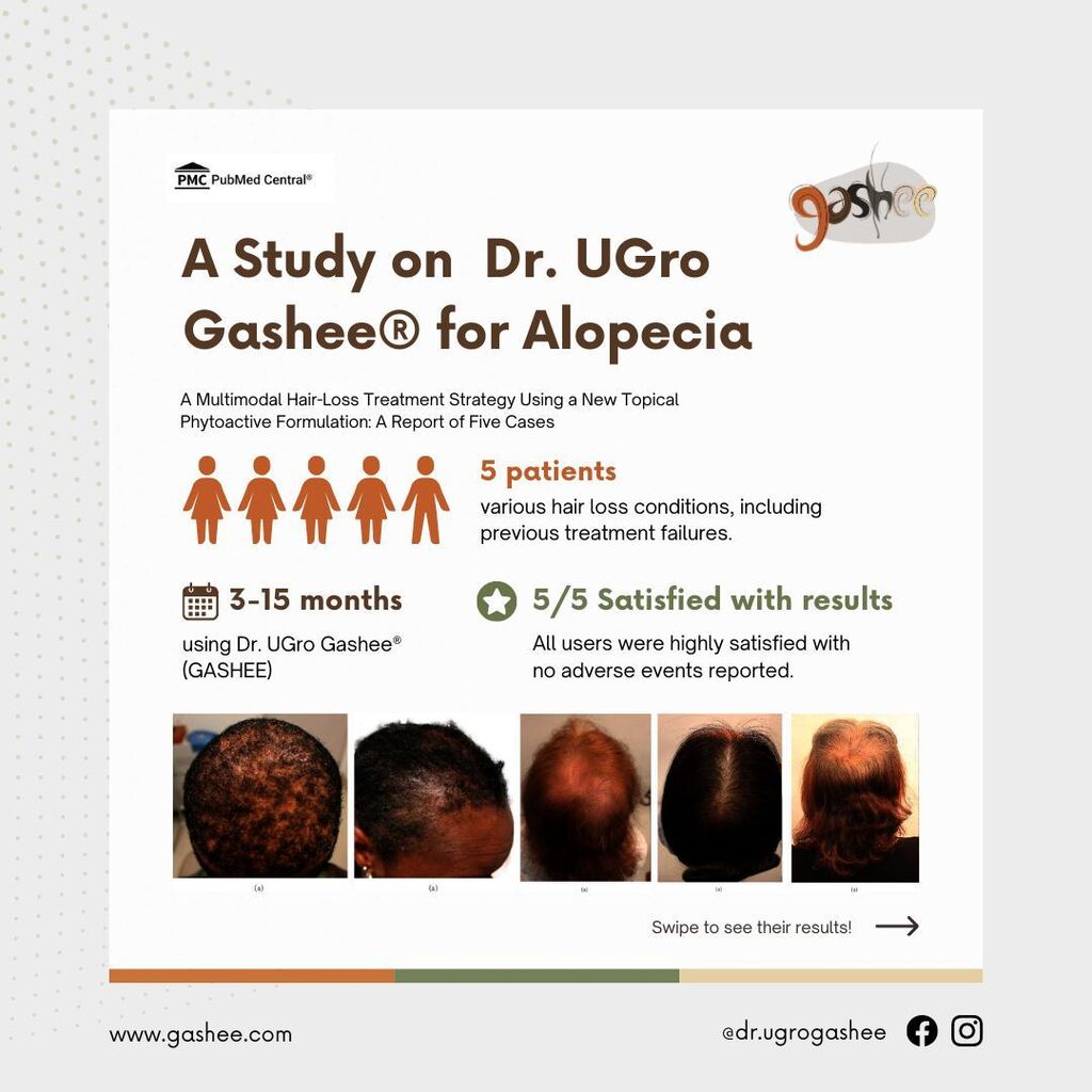 A Multimodal Hair-Loss Treatment Strategy Using a New Topical Phytoactive Formulation: A Report of Five Cases
