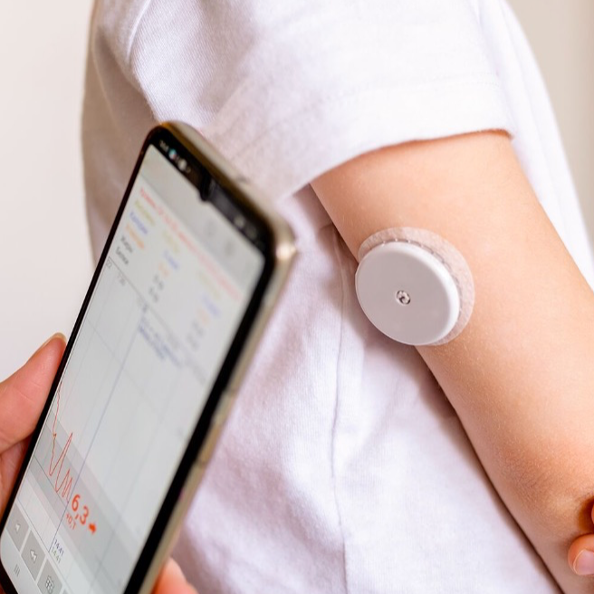 Continuous Glucose Monitor (CGM) Diabetes Game-Changer