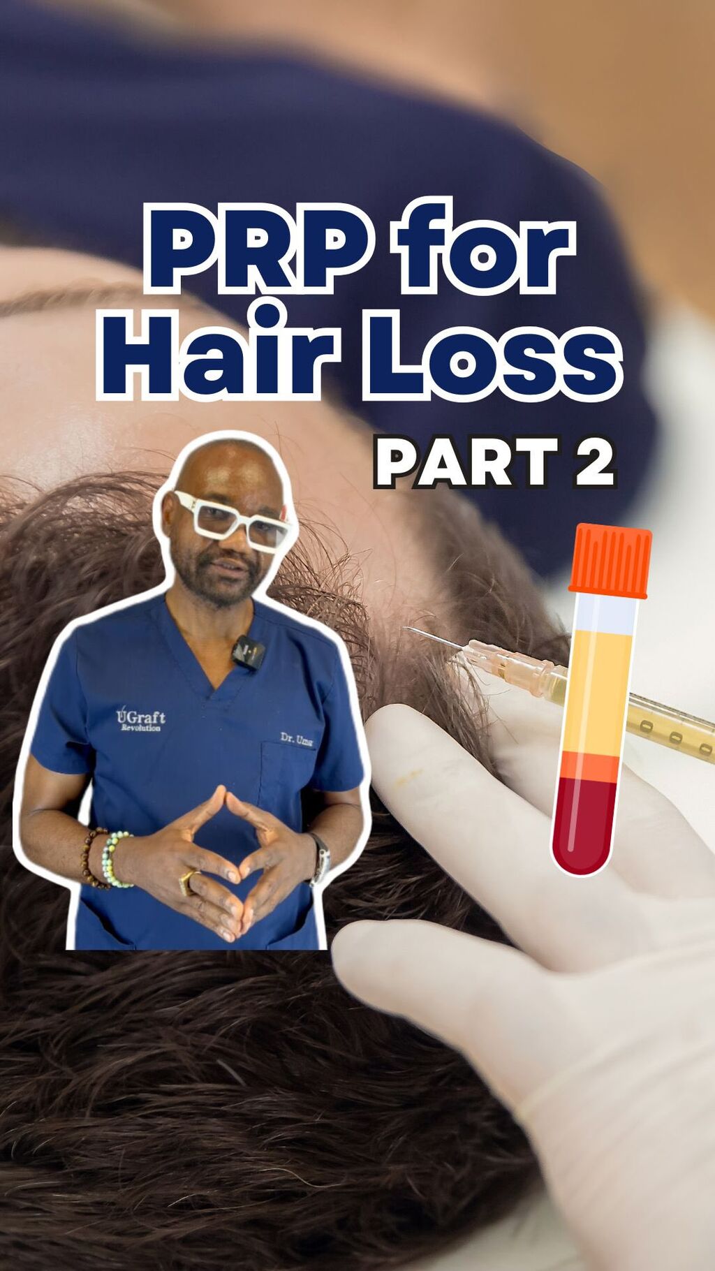 Does Platelet Rich Plasma Work For Hair Growth?