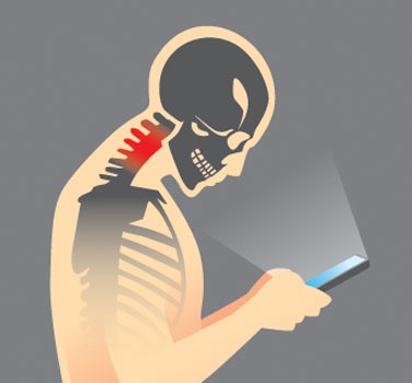 Neck Pain (Forward Head Posture FIX)