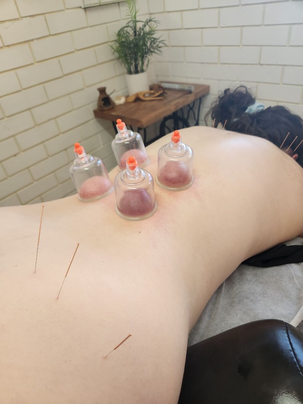 Holistic Myotherapy