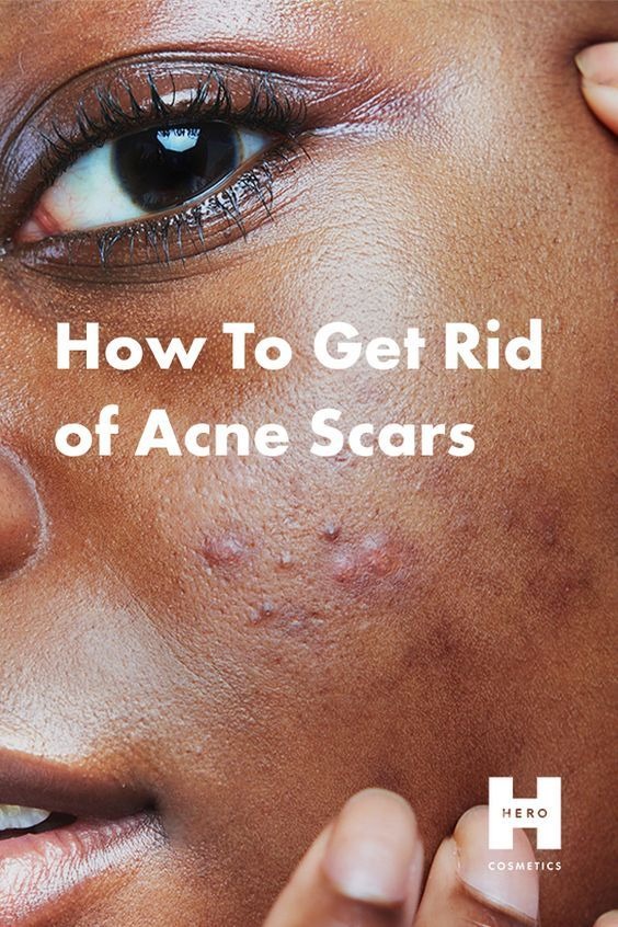 Get free organic ebook pro mixing Know your skin type today and know how to take care of your skin perfectly