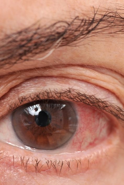 Completely Reverse Your Failing Eyesight In 7 Days With God&rsquo;s Miracle Tree Of Life Herb&hellip;