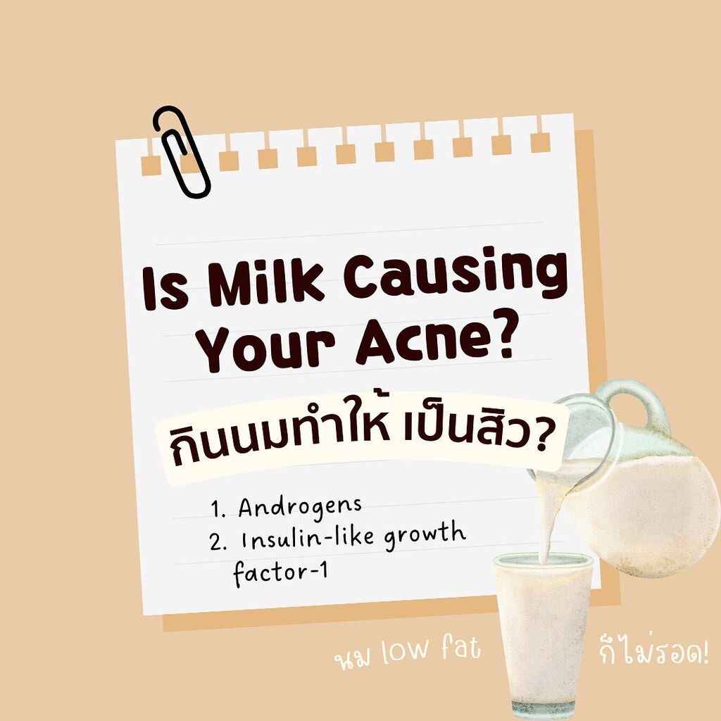 ผลวิจัยกินนมทำให้เป็นสิว
