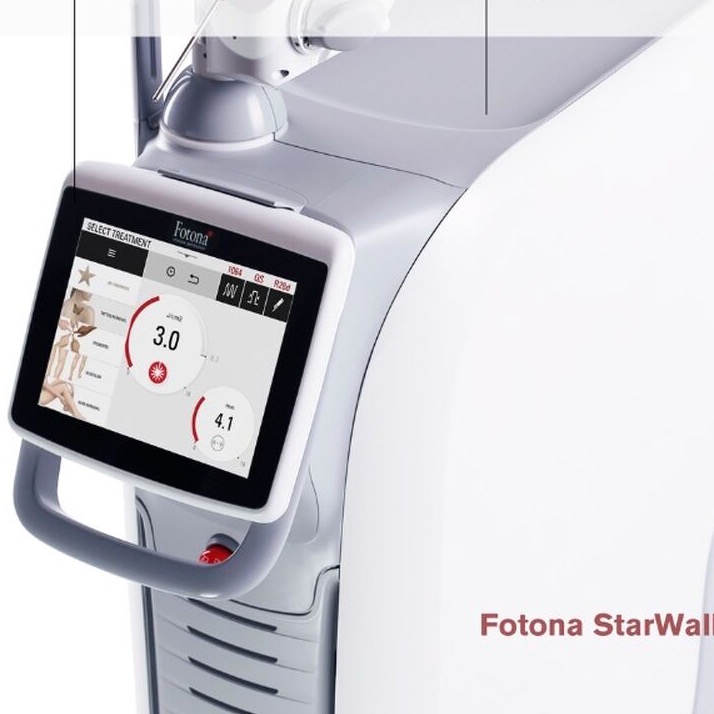 Melasma Laser