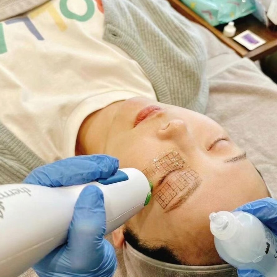 Thermage FLX Barbie Eye 