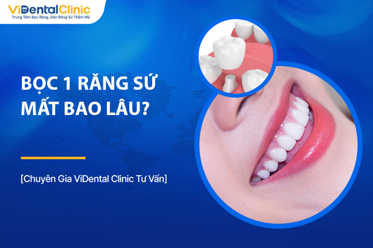 Đang Cho Con B&uacute; C&oacute; Trồng Răng Được Kh&ocirc;ng? Những Điều Mẹ Cần Biết