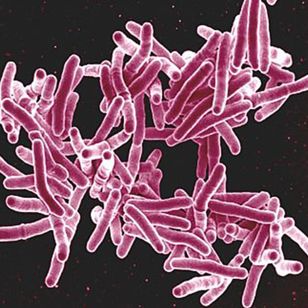 Targeting Tuberculosis