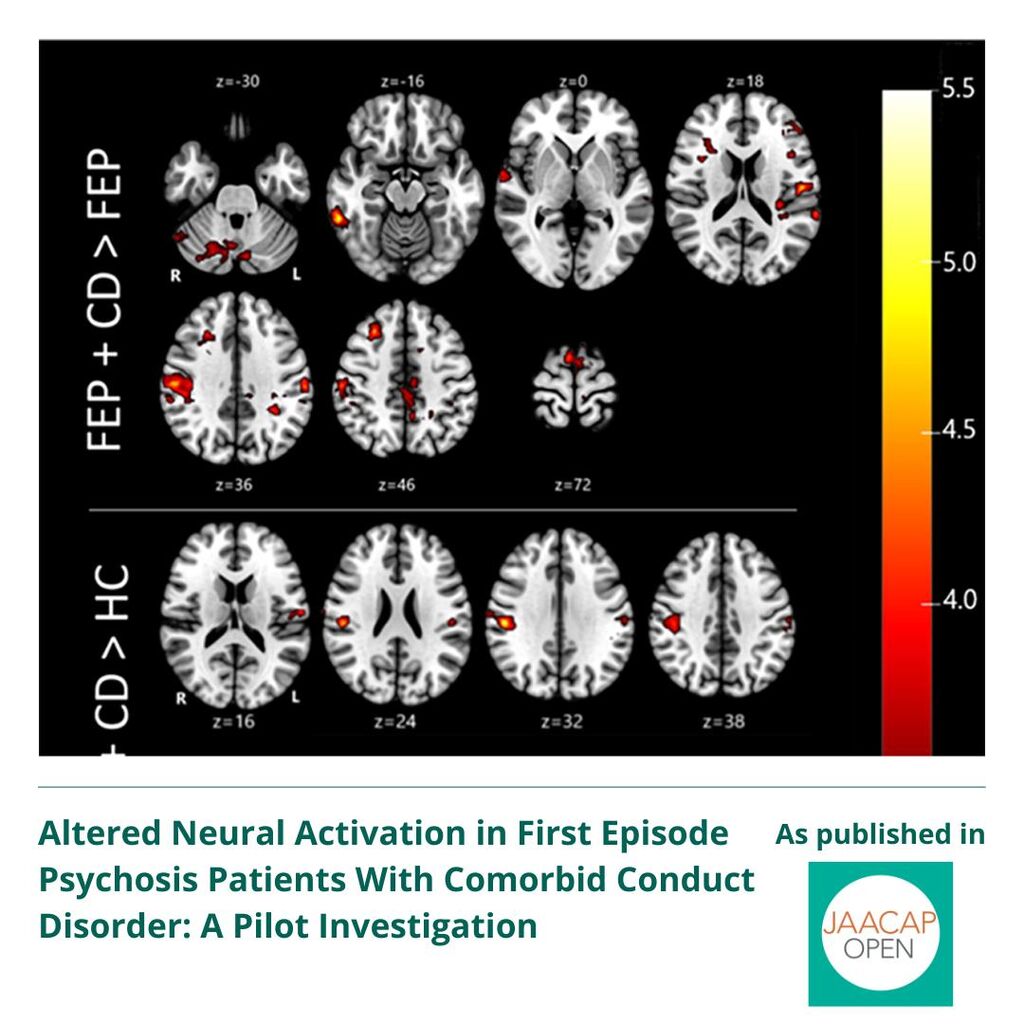 JO 0325 Altered Neural Activation