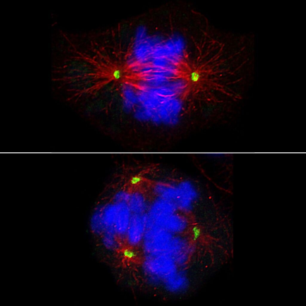 Robot-Assisted Experiments Point to Treatments for Rare Cancer