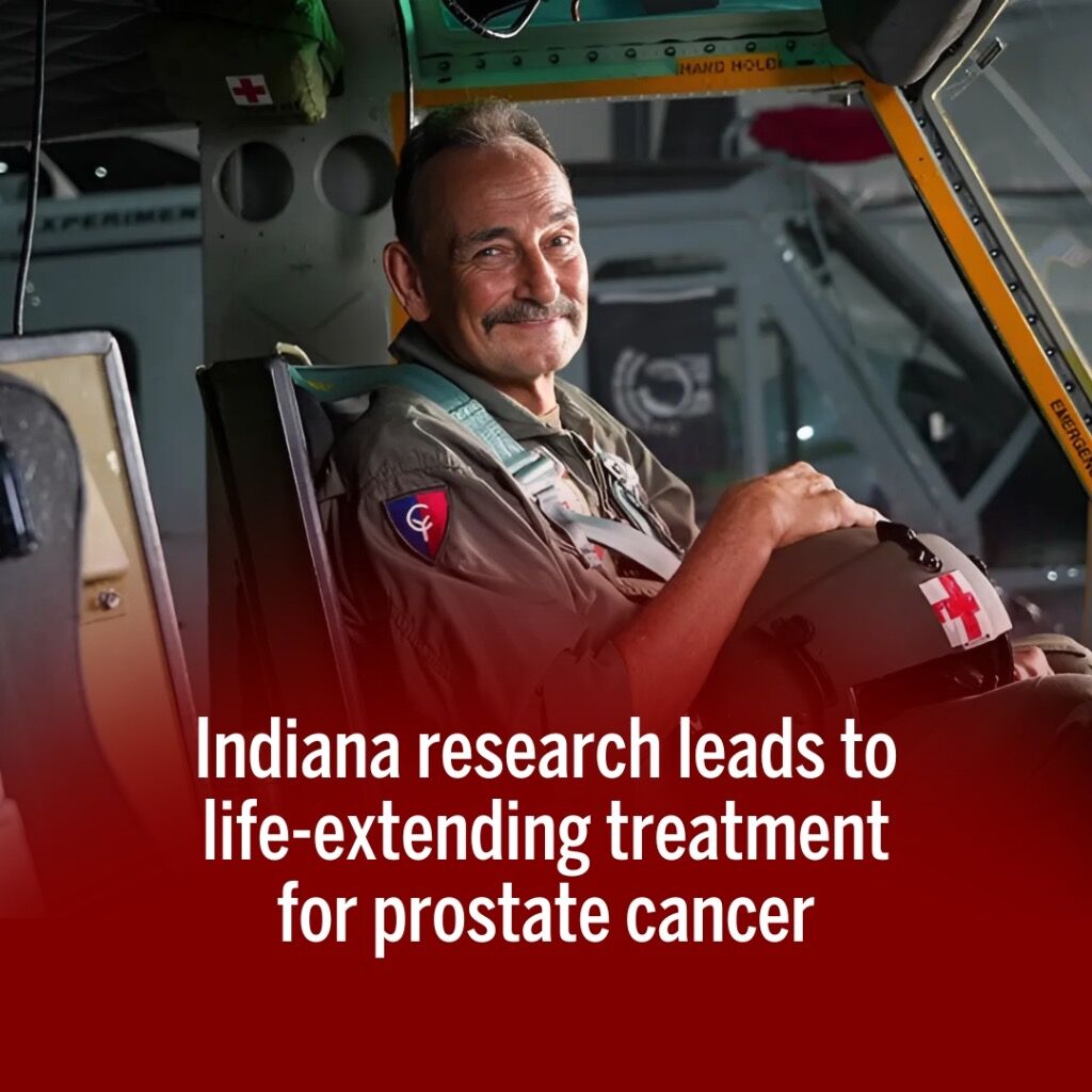Indiana research leads to life-extending treatment for prostate cancer: Articles: News & Publications: About Us: Indiana University Melvin and Bren Simon Comprehensive Cancer Center: Indiana University