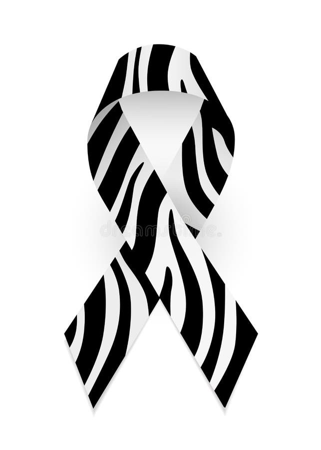 23 Signs You Grew Up With Ehlers-Danlos Syndrome