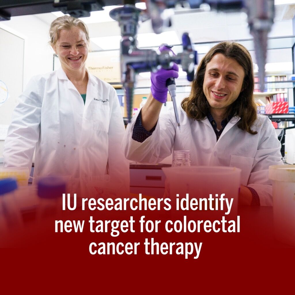IU researchers identify new target for colorectal cancer therapy 