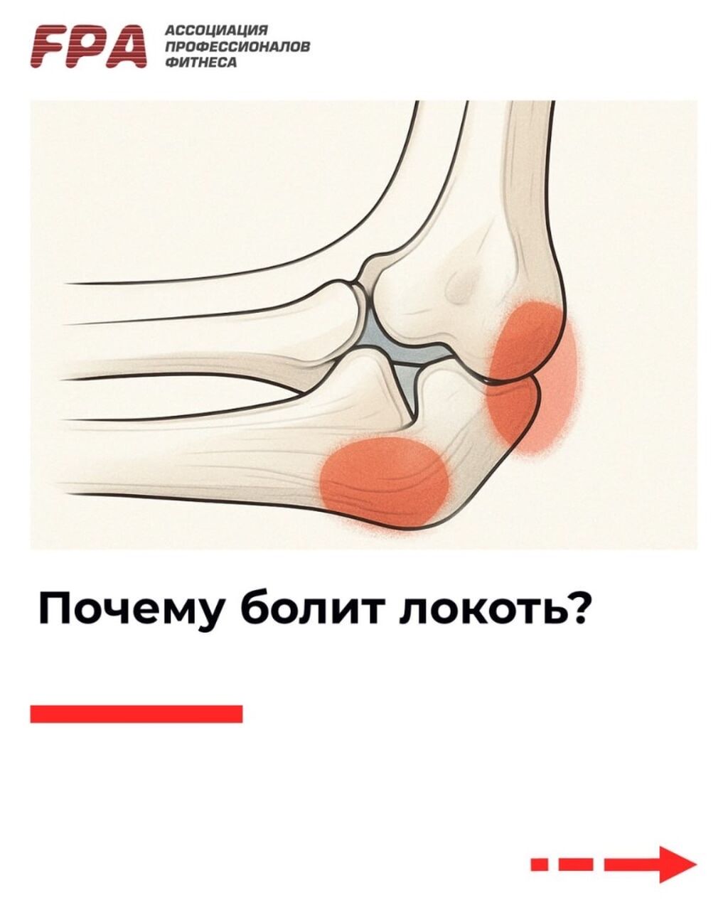 Статья