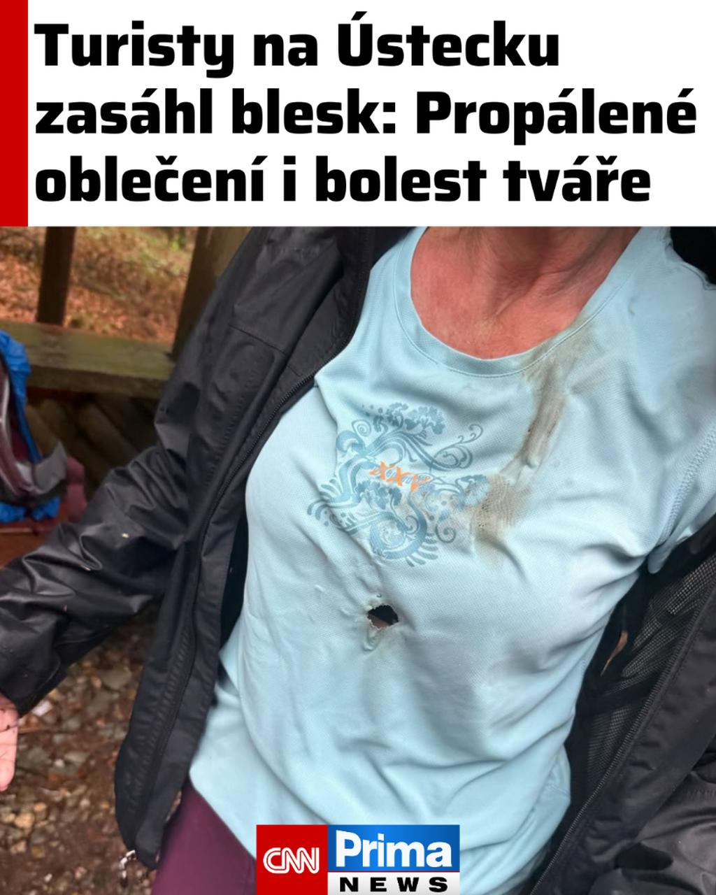 Turisty na &Uacute;stecku zas&aacute;hl blesk: Prop&aacute;len&eacute; oblečen&iacute; i bolest tv&aacute;ře 