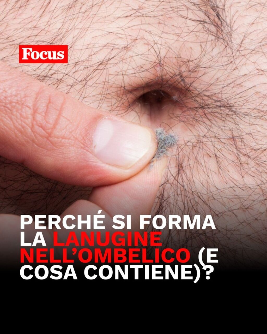 Perch&eacute; si forma la lanugine nell'ombelico?